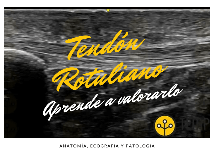 tendon-rotuliano-y-ecografia-aprende-a-valorarlo